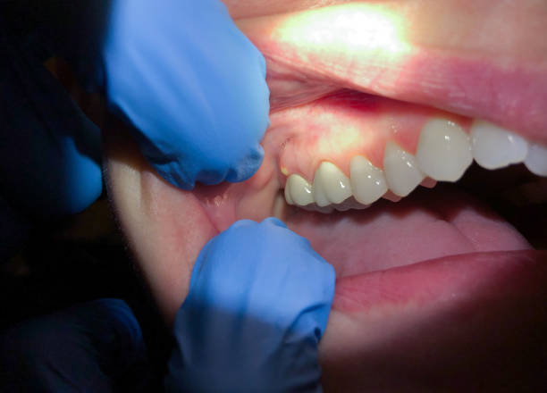 Best Cracked Tooth Emergency Dentist  in Raymond, MS
